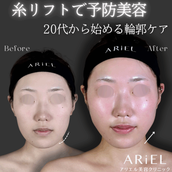 No.9195の症例写真